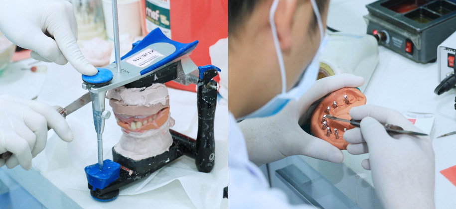 10倍放大镜下打磨义齿边缘；10个小时比对设计方案…将细节做到极致，只为让你用的舒适、美观。